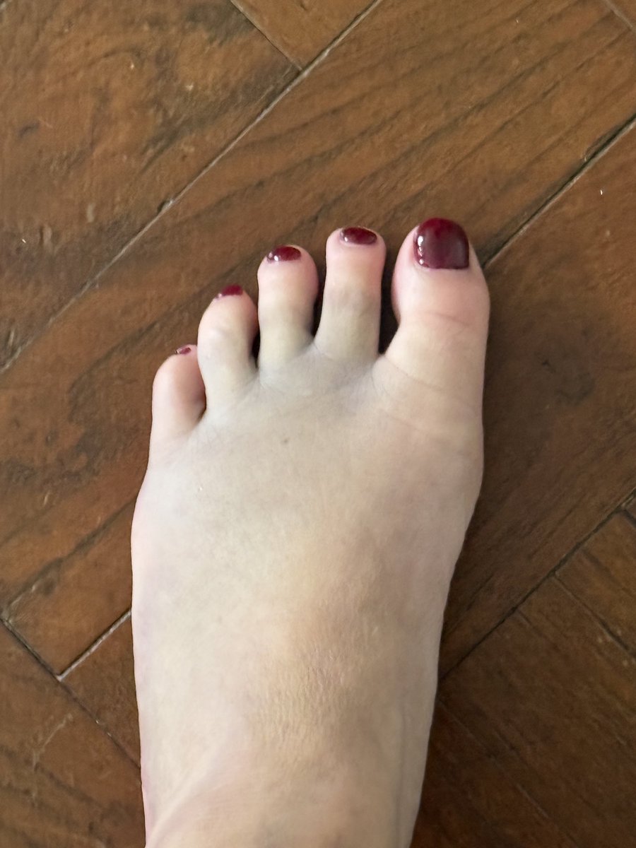Digiti_Pedis's tweet photo. I've only gone and fractured my little left foot!! All healing vibes appreciated. #littlefeet #feetworshi̇p #footfetish #feet #toes #swollenfoot #bruised https://t.co/8ZlEPZJiJX
