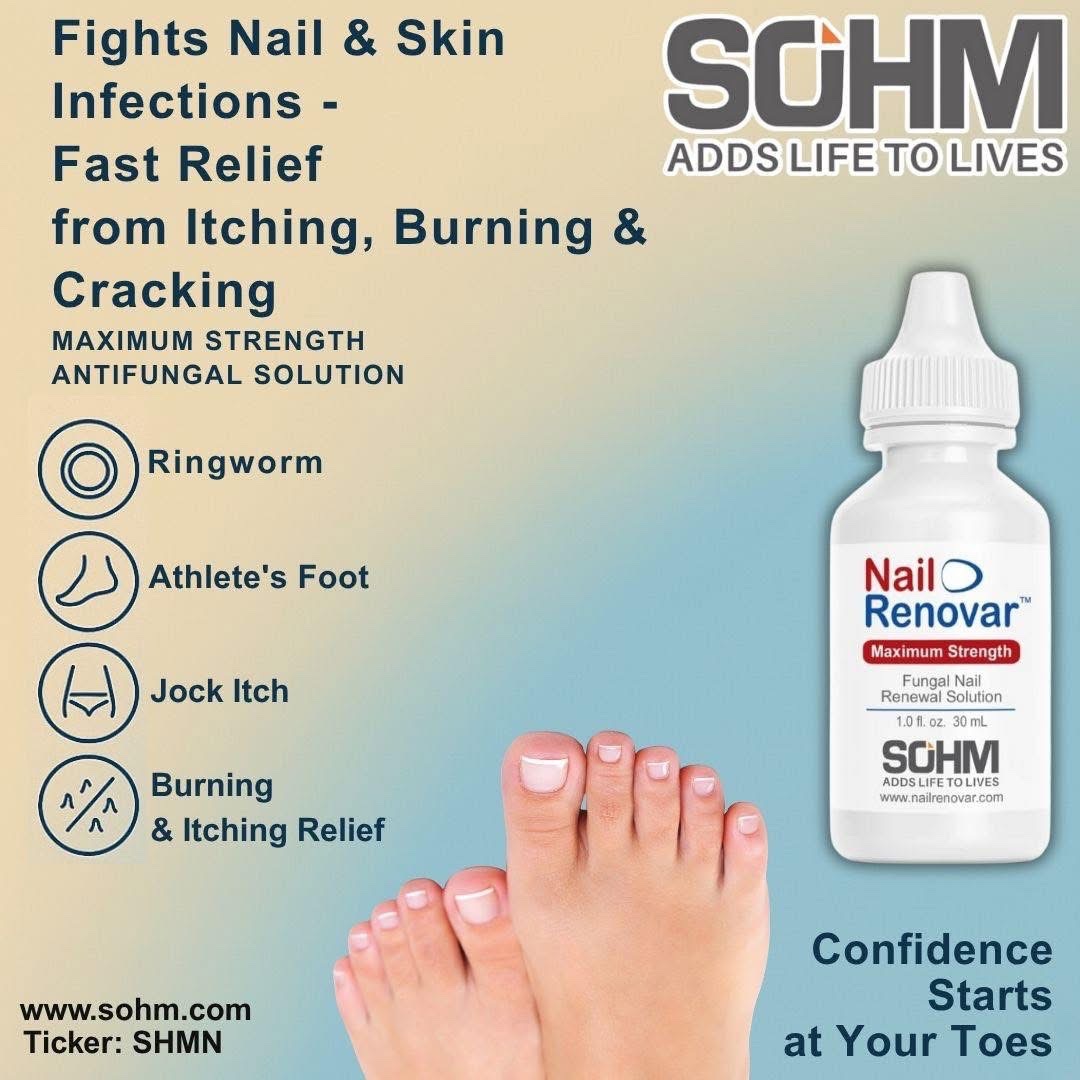 sohminc's tweet image. 💙 𝗦𝗢𝗛𝗠 𝗡𝗮𝗶𝗹 𝗥𝗲𝗻𝗼𝘃𝗮𝗿 — 𝗠𝗮𝘅𝗶𝗺𝘂𝗺 𝗦𝘁𝗿𝗲𝗻𝗴𝘁𝗵, 𝗠𝗮𝘅𝗶𝗺𝘂𝗺 𝗖𝗼𝗻𝗳𝗶𝗱𝗲𝗻𝗰𝗲! 👣

Itching, burning, and cracking on skin holding you back? Or fungal nails shaking your confidence?

Fight infections fast with SOHM Nail Renovar — your go-to antifungal…