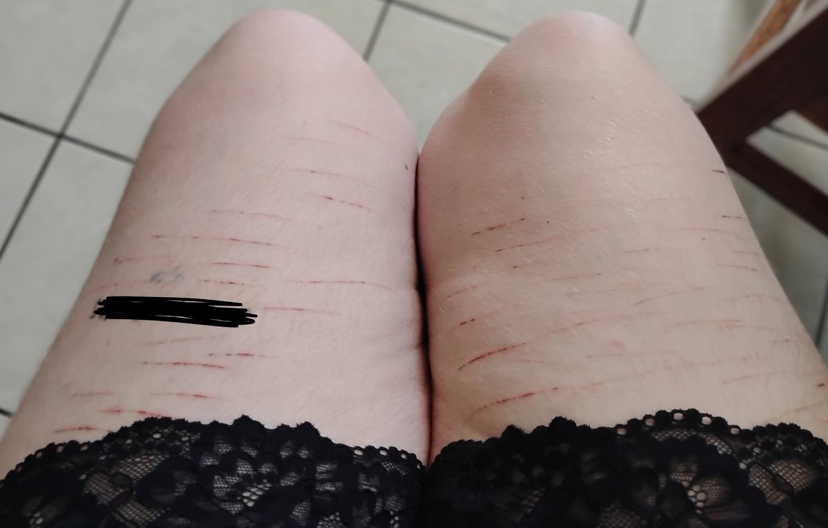 junkbltch's tweet image. i hate the shape of my thighs jfc they dont even look the same