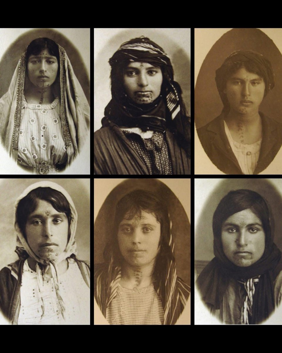 During the Armenian Genocide (1915-1917), many Armenian women were forcibly tattooed, often on the face, as a means of control and forced assimilation. Some later escaped to orphanages or shelters, but the tattoos remained as lasting marks of trauma. Stigmatized and excluded,