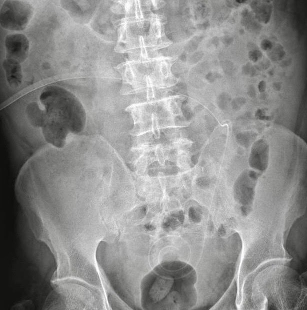 Juan Carlos Flores 🇲🇽 M.D. FISN tweet media