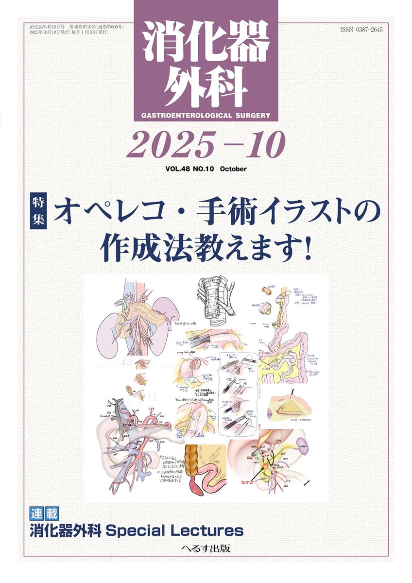 消化器外科2025年10月号』 概要 オペレコ・手術イラストの作成法教え