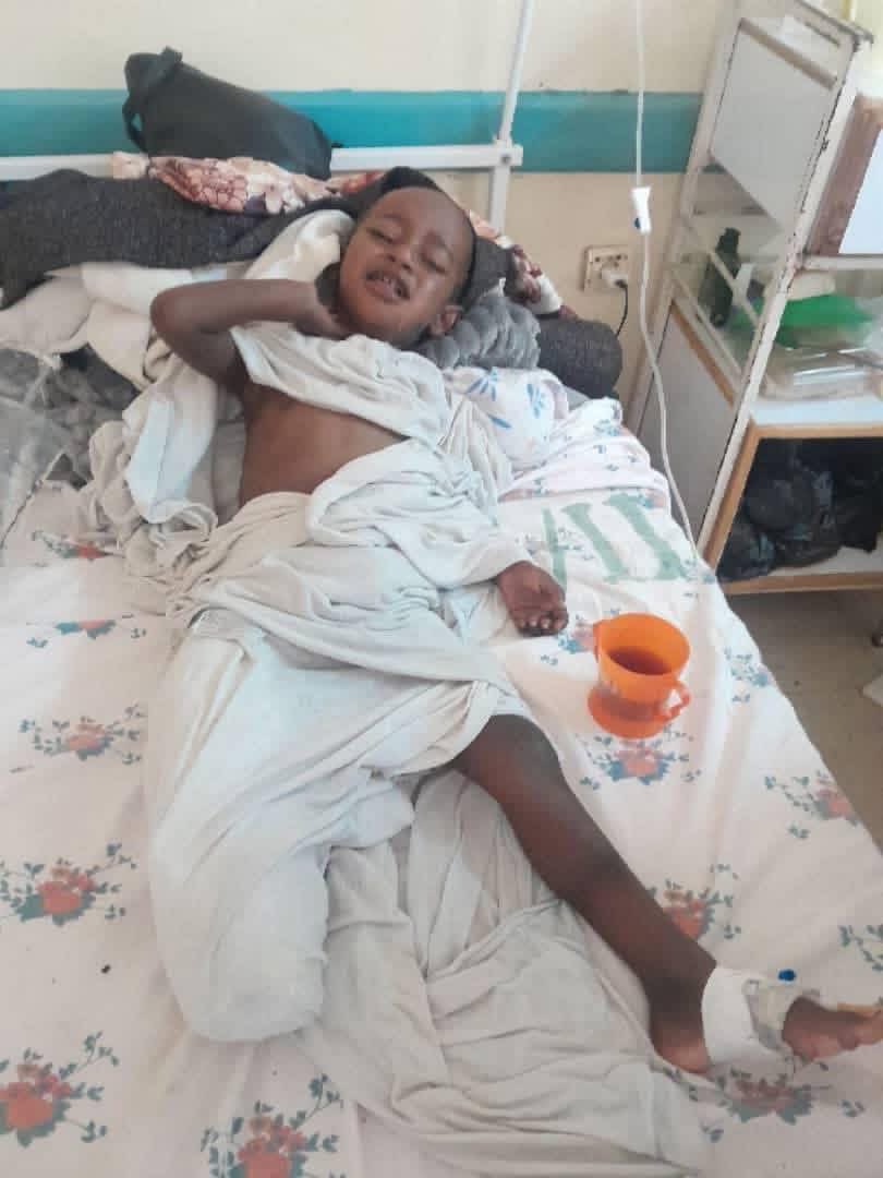 mesgan27's tweet photo. Four‑year‑old Tamrat Awgetchew’s leg was amputated. In Ethiopia’s Oromia region, Arsi, it is worth remembering that more than 25 Orthodox Christians were killed in a government‑sponsored attack on Orthodox Christians last week. He was shot repeatedly in the leg during the attack and hospitalized, but today his leg was amputated because of severe injuries.