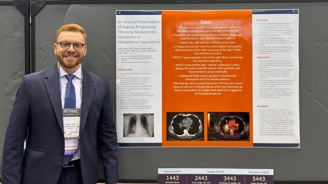 TH_IMRES's tweet photo. Proud moment for our residency team! 👏

Dr. Javid Taghados (PGY-3) presented his work at the CHEST Conference in Chicago. Another great example of how Thomas Hospital fosters research, collaboration, and professional growth.

#CHESTConference #MedicalResearch #ThomasHospital https://t.co/Yl5sCTXWVT