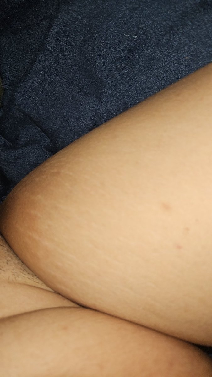 Day 5 of #NonStopNutNovember 
Do you like my stripes~