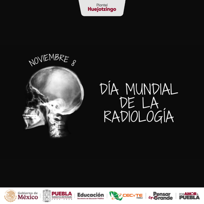 El 8 de noviembre es el Día Mundial de la Radiología, una fecha ideal para conocer el rol que juega esta especialidad en la salud de las personas.
Gracias a la radiología hoy en día se pueden curar fracturas, poner prótesis adecuadas a cada situación.