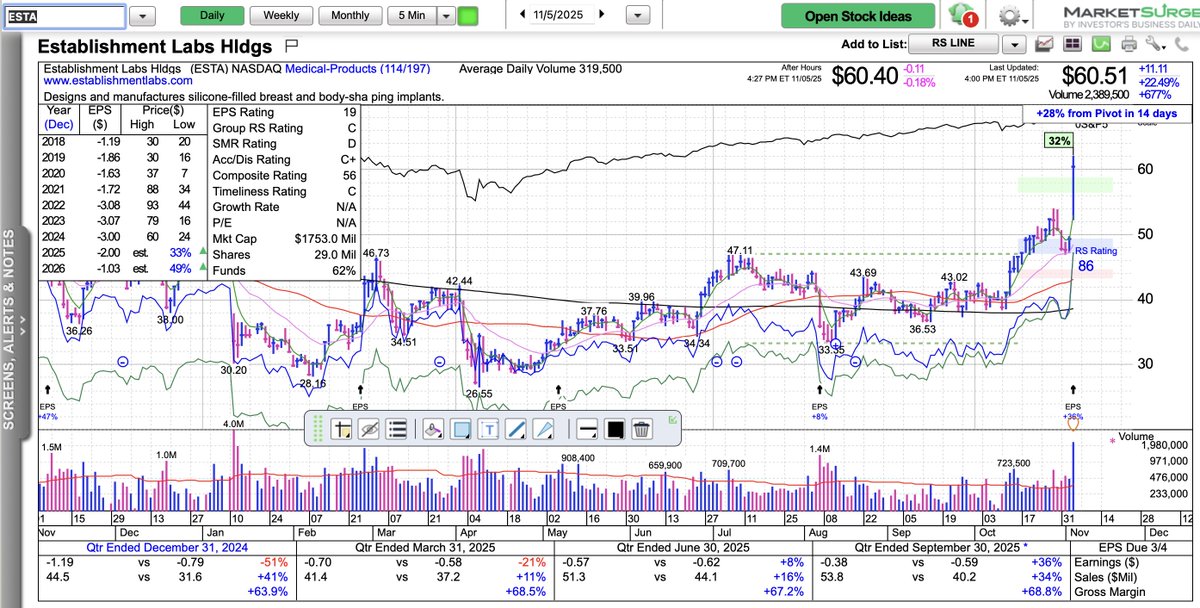 MartyChargin's tweet photo. $ESTA ... I just noticed.... This breast implant stock “BUSTed out” today.... with massive volume.... not to be ignored.... Dan.... No Jokes please🤣😂📈... https://t.co/EoaxxYFeZy
