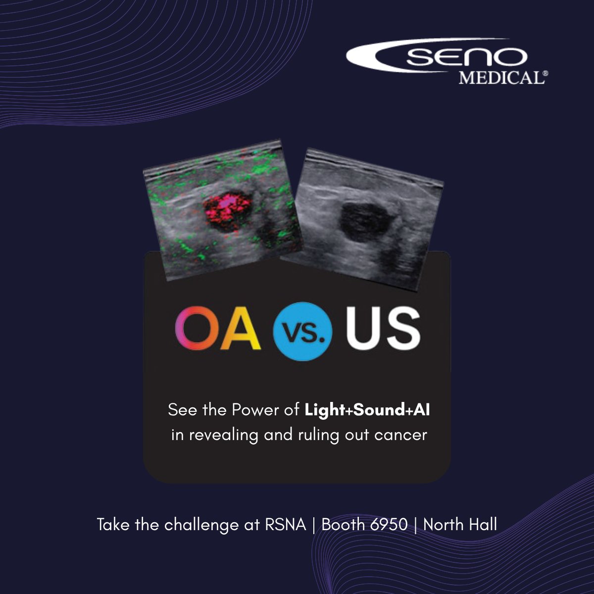 Test your skills with side-by-side case examples of ultrasound and opto-acoustics imaging to diagnose malignant breast tissue. Stop by booth 6950  (North Hall) while you are at RSNA.

#RSNA #breastcancer #optoacoustics #imagio