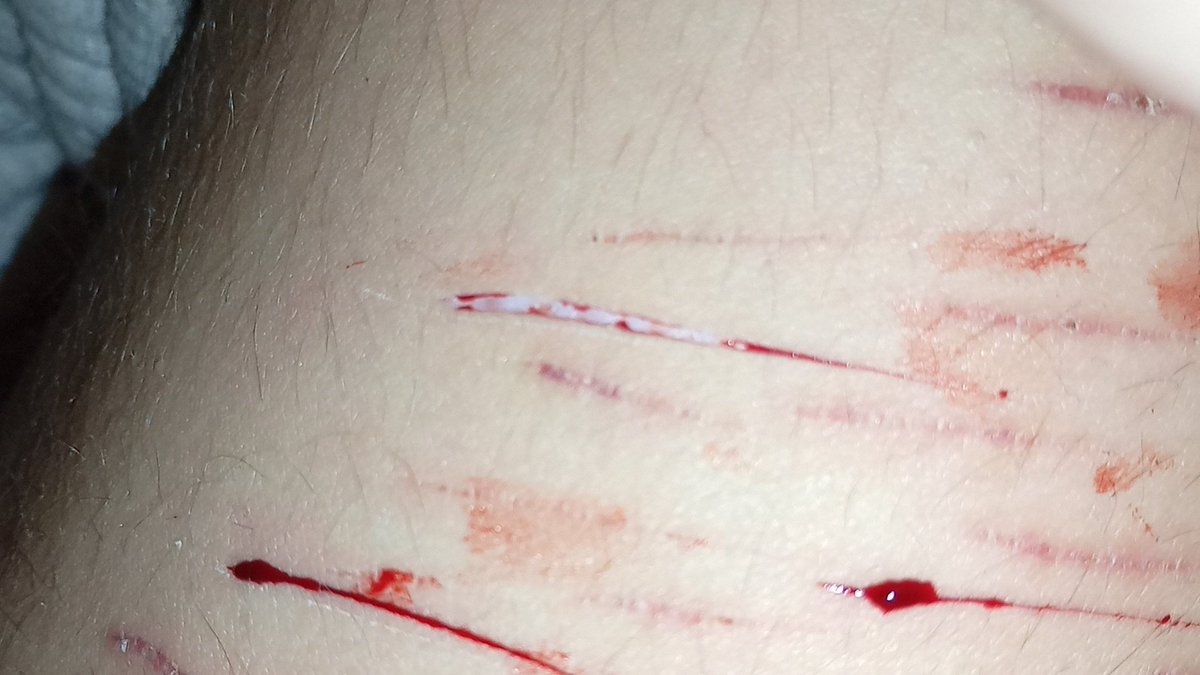 boo_xmo's tweet photo. que calidad tan deplorable 😿#shtwt #shelfharm https://t.co/LLQL3xvdYt