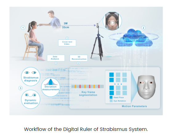 WSPOS's tweet image. SYSU team develop smartphone-based digital ruler for automated strabismus measurement - Research led by Prof. Haotian Lin from Sun Yat-sen University (SYSU), in collaboration with Prof. Feng Xu from Tsinghua University,
sysu.edu.cn/sysuen/info/10…