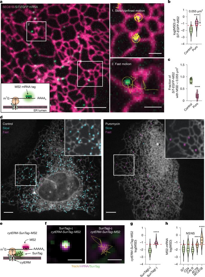 LabWaggoner's tweet image. Mechanism by which ER junctional proteins &amp;amp; lysosomal activity cooperatively pattern secretome mRNA translation, linking ER architecture and nutrient sensing to the production of secretory and membrane proteins
nature.com/articles/s4158… @Nature @JLS_Lab