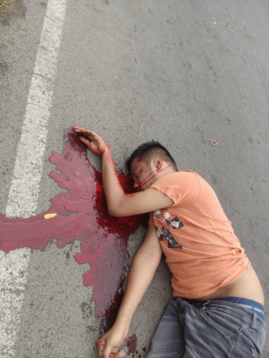 CuddaloreC's tweet image. #கடலூர் ஜவான் பவன் சாலையில் இரண்டு சக்கர வாகனத்தின் மீது லாரி மோதி விபத்து, 108 ஆம்புலன்ஸ் மூலம் ஆபத்தான நிலையில் இருந்த இருவரையும் கடலூர் அரசு மருத்துவமனைக்கு அனுப்பி வைக்கப்பட்டனர், உறவினர்கள் உடனடியாக மருத்துவமனைக்கு செல்லவும்.....