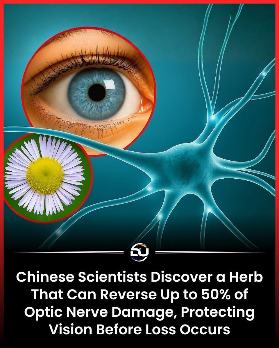 👁️ Нүдний харааг алдахаас өмнө хамгаалах байгалийн ургамлын нээлт! 🌿

Хятадын эрдэмтэд нүдний мэдрэлийн гэмтлийг 50% хүртэл сэргээх чадвартай ургамлыг илрүүлжээ.
Хараа муудах шинж илрэхээс 훨 өмнө нүдний мэдрэл үхжиж эхэлдэг бөгөөд энэ ургамал нь тэр үйл явцыг зогсоох боломжтой