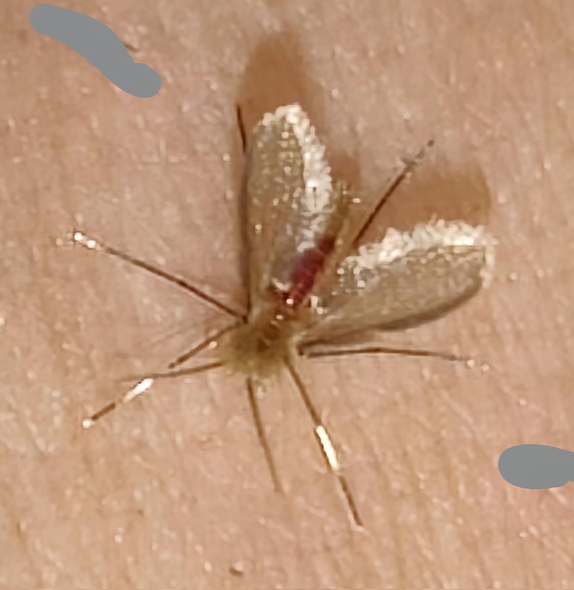 I woke up with an insect bite on my hand, and now it hurts terribly. My family and I can't sleep and all my pleas for decent housing or reasonable rent have been in vain. I'm now asking for $2,000 to buy basic necessities so I can live like a normal person
gogetfunding.com/tasnimyusuf/