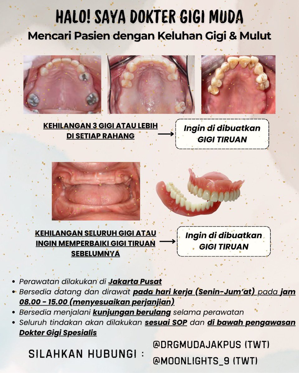 Halooo smua 🌸🦷
dicari pasien kehilangan gigi yang ingin dibuatkan gigi tiruan seperti pada gambar! kalau kalian atau anggota keluarga ada dengan kondisi tsb boleh banget dm! 

#gigitiruan #gigitiruanmurah #gigipalsu #koasgigi #pasiengigi #gigiompong #gigihilang #zonauang