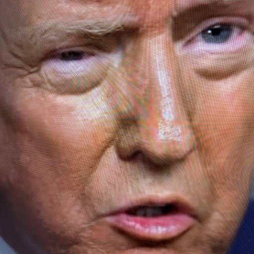 GetTheDailyDirt's tweet photo. EYE WIDE SHUT: #HealthAlarm After President's #RightEye Is Swollen During 60 Minutes Interview...
#OMG...Where #Trump went on a wild #Conspiracy rant...
#WTF... The new #CBS bosses cuts the "Corruption Tantrum" From #60Minutes Edit...
https://t.co/bzO9tp9ipW https://t.co/5vpeSQvgDp