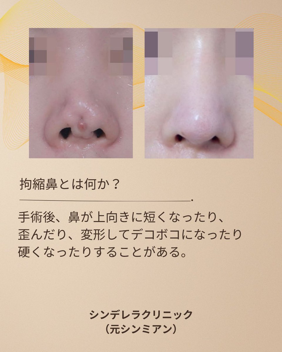 ジョン・ドンハク院長(現シンデレラ美容外科／元シンミアン整形外科