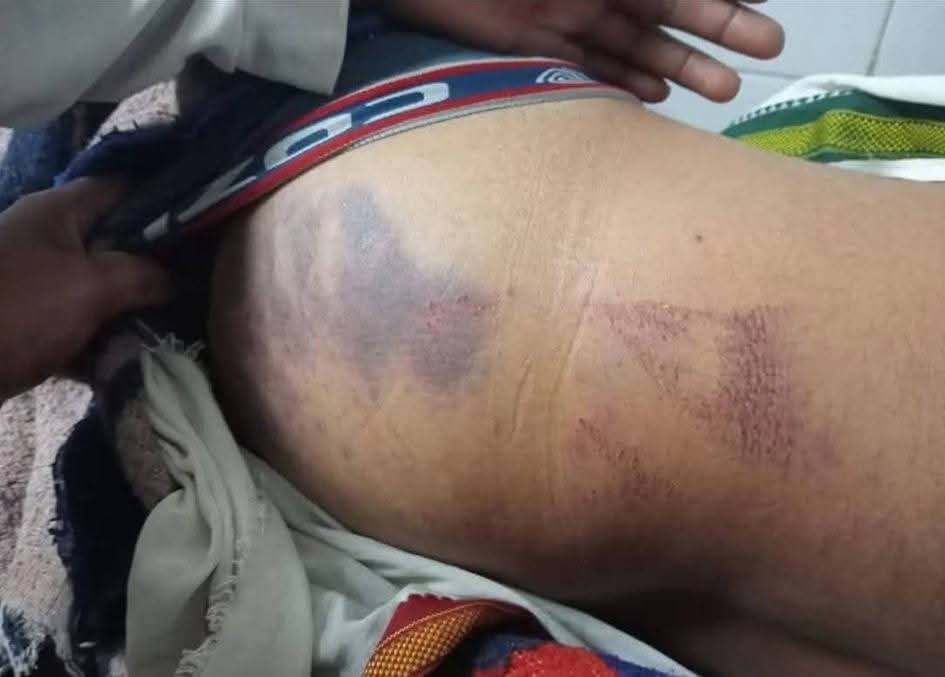 IshanAnandbsp's tweet image. #भाजपा सरकार में #पुलिस वेलगाम 

#तिलहर बिधानसभा छेत्र के #बसपा कार्यकर्ता सत्यभान की दरोगा राहुल सिसोदिया वा अन्य सिपाही के द्वारा पिटाई करने से मौत मौके पर पहुंचे बहुजन समाज पार्टी के जिला अध्यक्ष #शाहजहांपुर पूर्व विधायक प्रत्याशी 134 पुवायां 
1/2