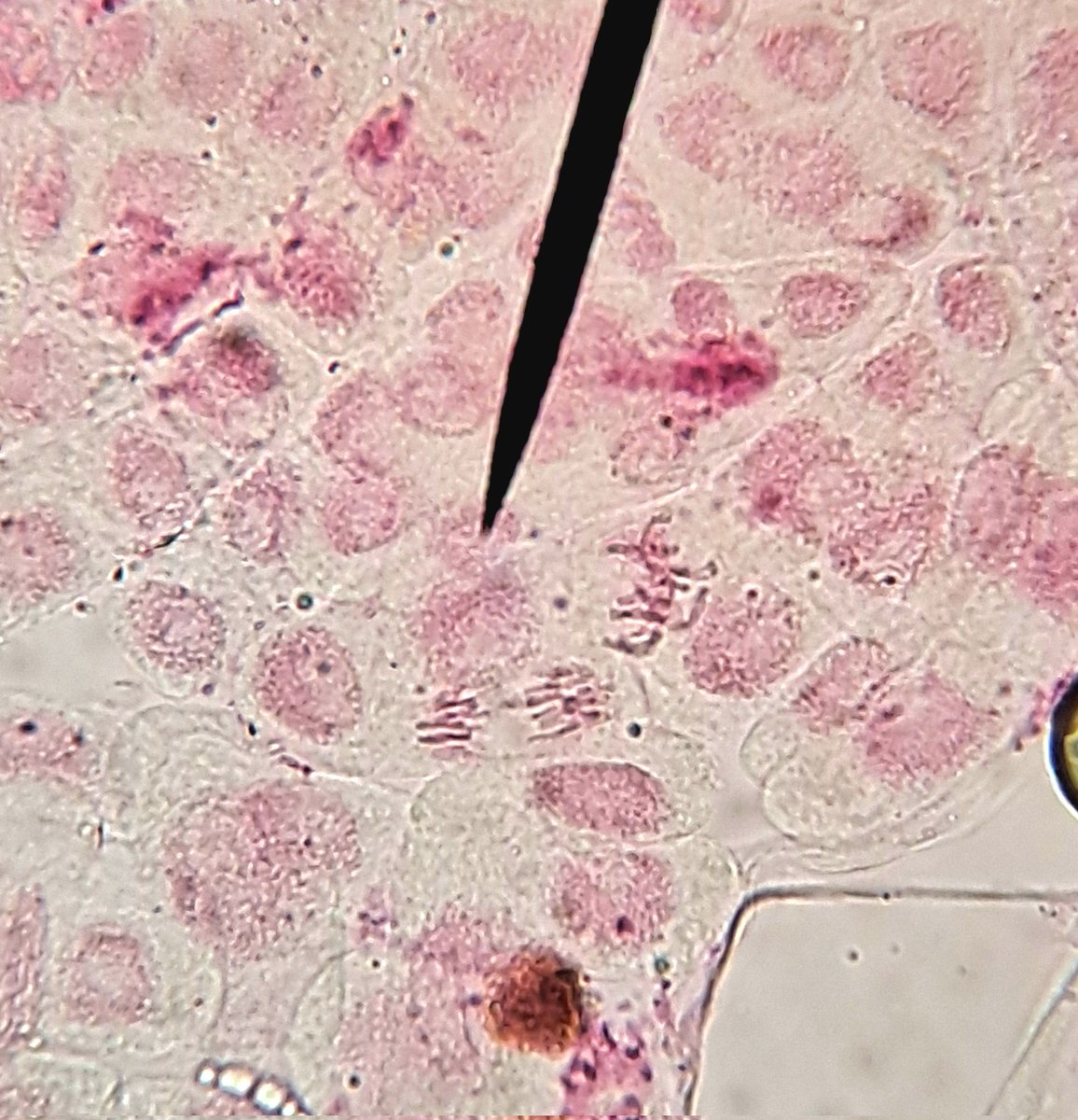 Eri solunjakautumisvaiheita mikroskoopissa.