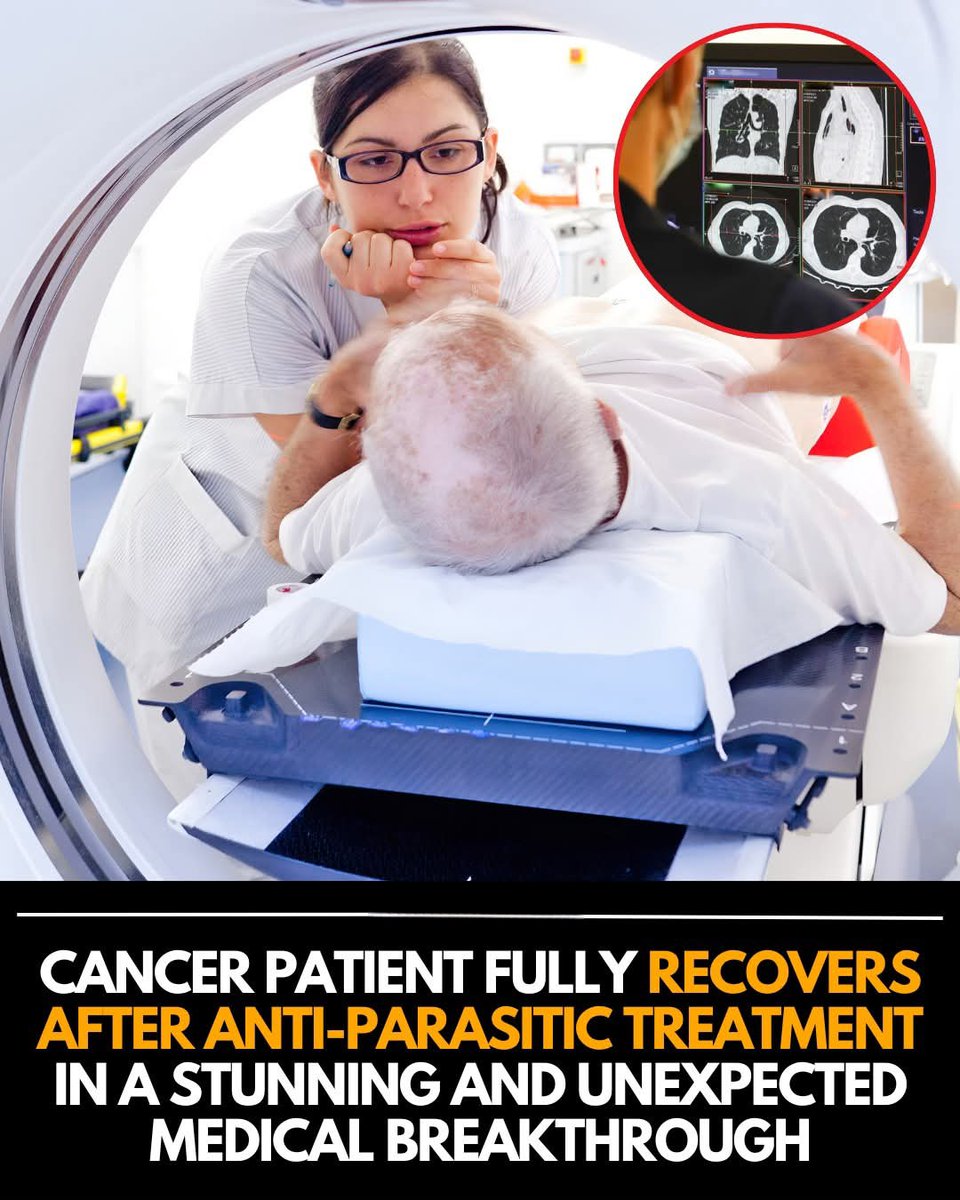 ShiningScience's tweet image. In an extraordinary case that has baffled doctors, a terminal cancer patient made a complete recovery after receiving an anti-parasitic drug typically used to treat infections. Within just a few weeks of starting the therapy, medical scans showed a total disappearance of tumors,…
