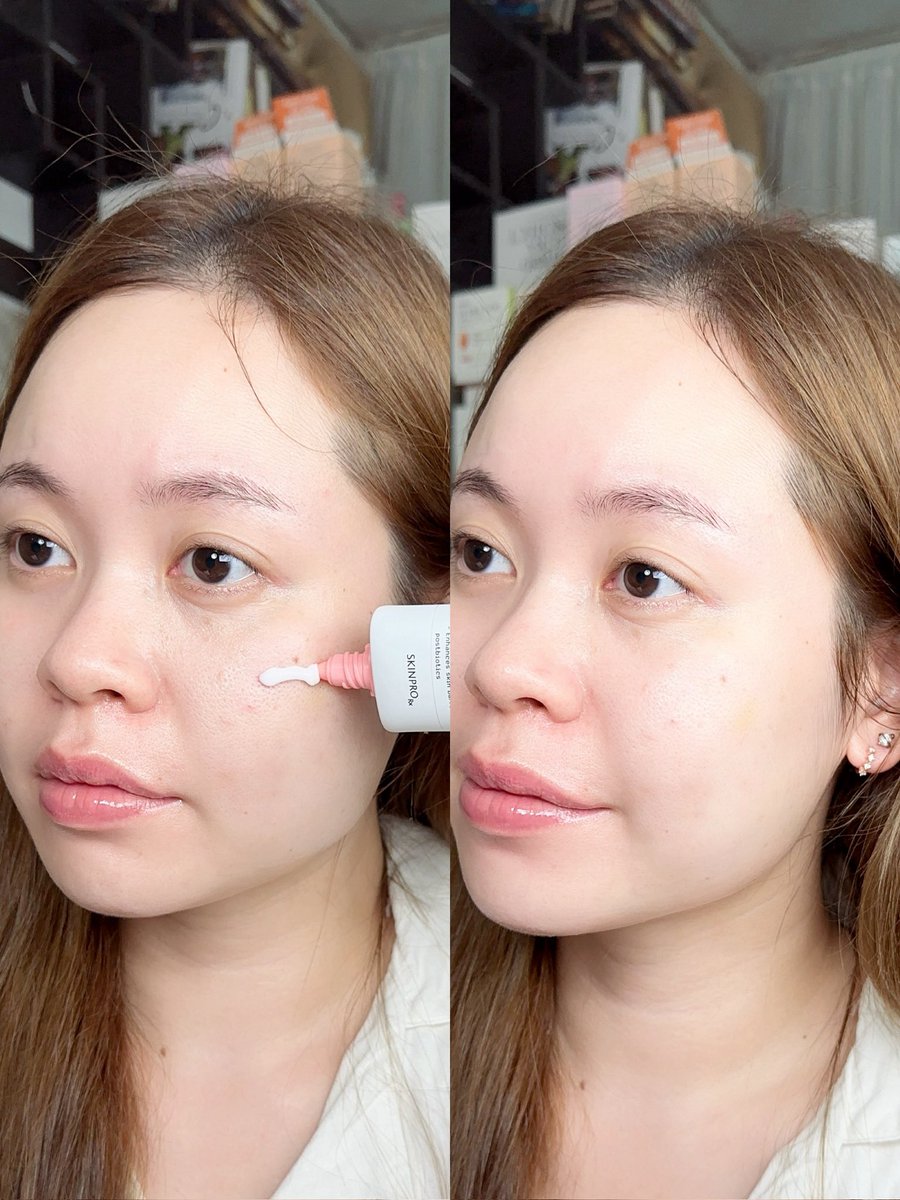 aispdiary's tweet image. ตอกย้ำความจึ้งของ SKINPRO Rx ของพรเกษมคลินิก ที่เข้าใจผิวหนังคนไทย! นี่หลอดที่ 2 แล้ว Sensitive Skin Moisturizing Cream ตัวนี้ช่วยให้ผิวชุ่มชื้น ช่วงเป็นสิวก็ใช้ตัวนี้แหละ มี Cica เค้าปลอบประโลมผิวดีมาก ลดการอักเสบ การระคายเคือง และ Postbiotics ปรับสมดุลผิว