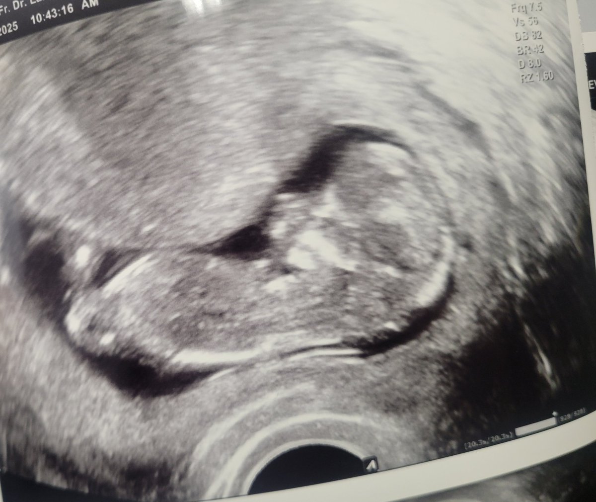 Kann das immernoch nicht glauben 🙏🥺❤️