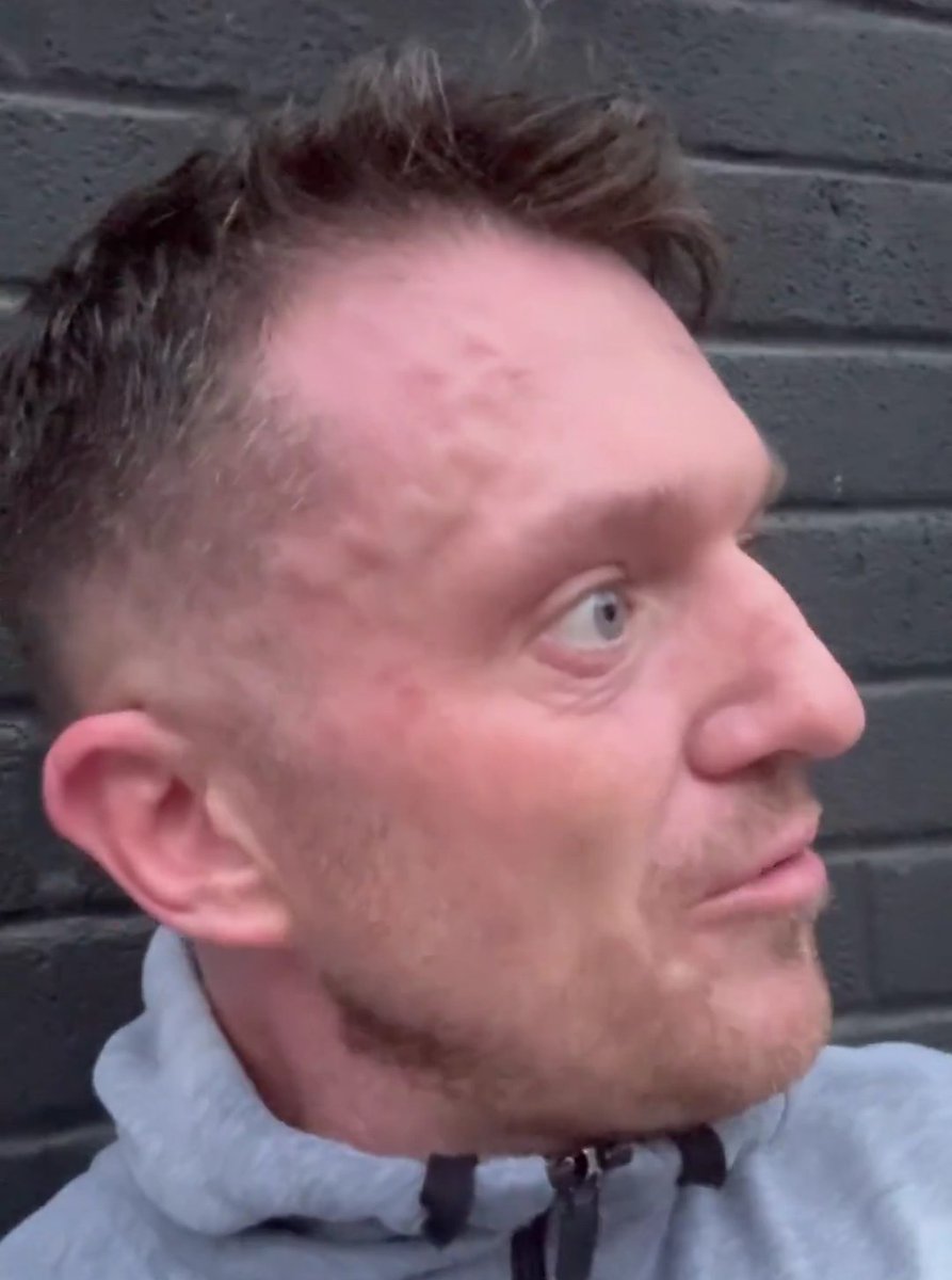 OWS1892's tweet image. Is that vein in his temple growing?