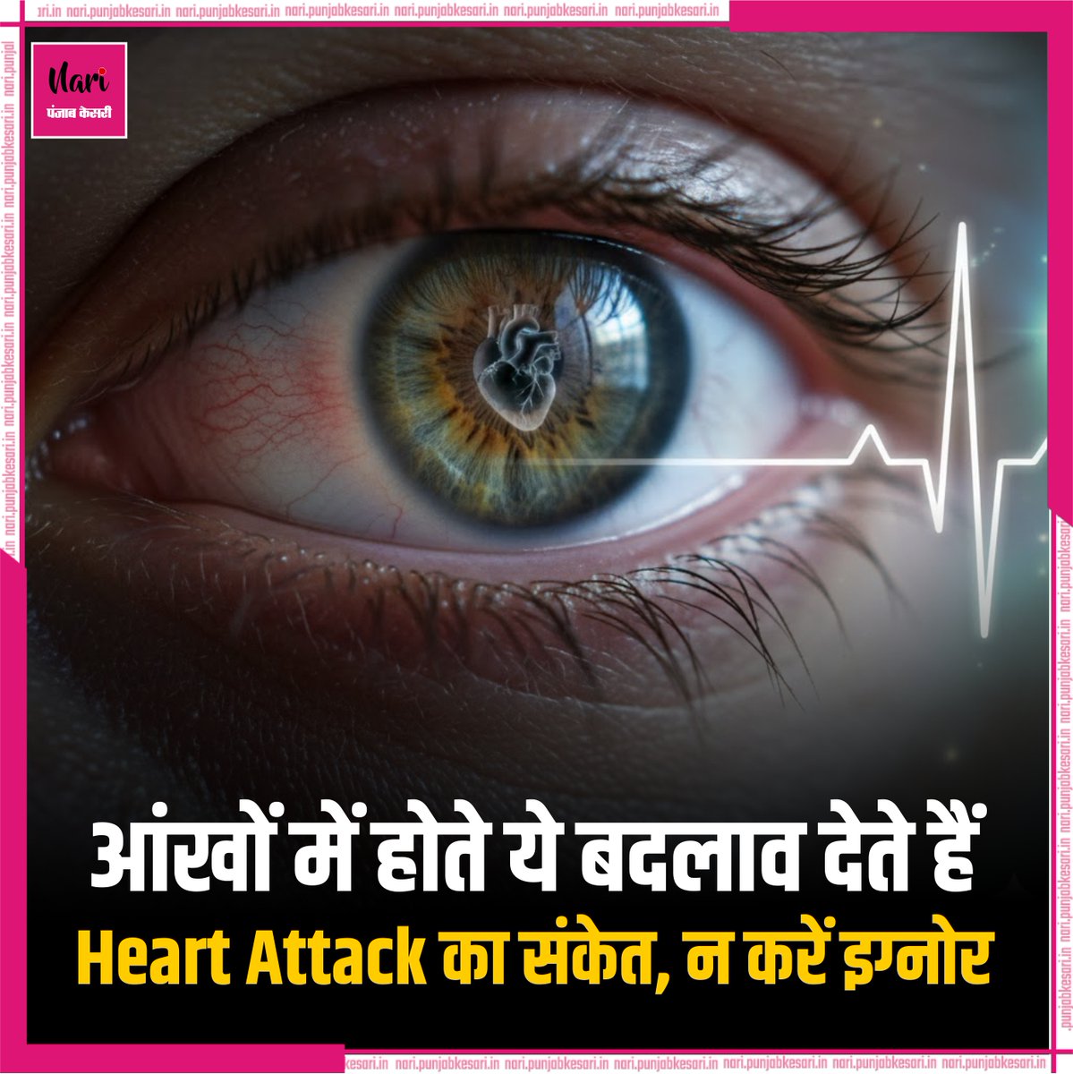 NariKesari's tweet image. आंखों में होते ये बदलाव देते हैं Heart Attack का संकेत, न करें इग्नोर

nari.punjabkesari.in/nari/news/hear…

#HeartAttack #HeartAttackSymptoms #HeartProblems #EyeSymptoms