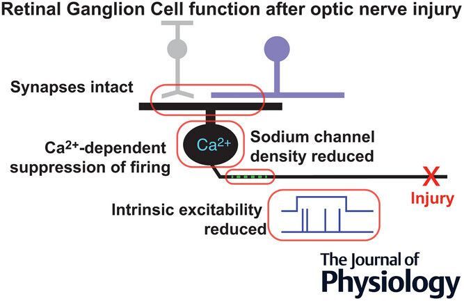 JPhysiol's tweet image. In this study, Thomas E. Zapadka (@YaleMed) et al. observed that #optic nerve injury impairs intrinsic mechanisms underlying electrical activity in a resilient #retinal ganglion cell 👁️ 🔬 

📜 Read the #Research: buff.ly/ptGnBXz