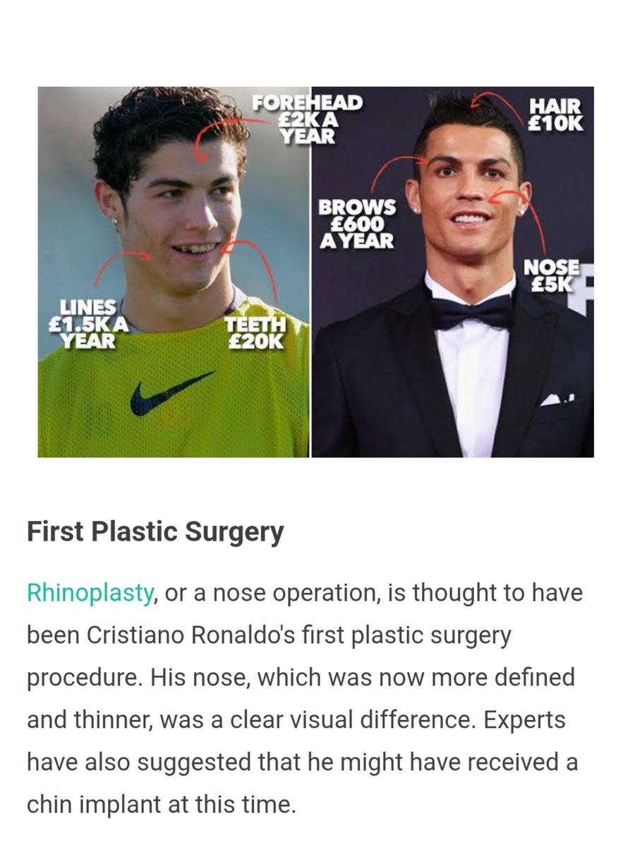_Redduuu_'s tweet photo. He is not normal cz he is a plastic surgery bum. This is his so called perfectness lol. https://t.co/gXjBv8SZIb