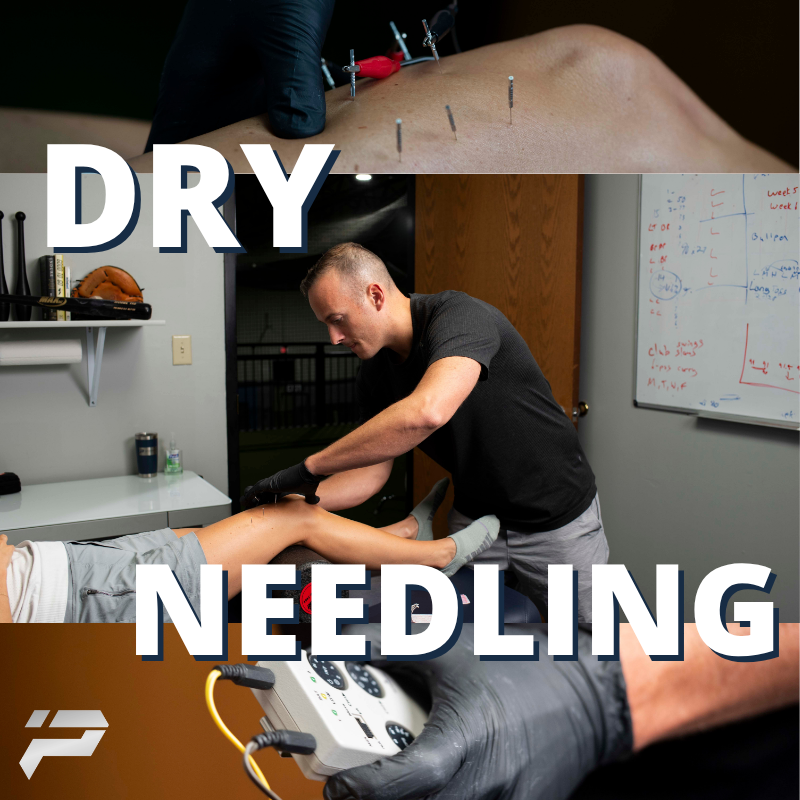 Foam rolling fails when the knot is deep. If chronic tightness limits your power on the field/mound, dry needling may be right for you.

Dry Needling targets that trigger point directly for an instant reset in muscle tension and mobility. It's precision care for high performance.