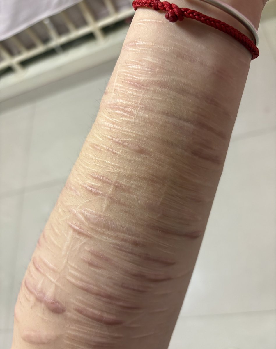 youyou_726's tweet photo. 好想割手🤣不能割手😭好想割手🤣不能割手😭好想割手🤣不能割手😭好想割手🤣不能割手😭好想割手🤣不能割手😭好想割手🤣不能割手😭好想割手🤣 https://t.co/omcoxF3frX