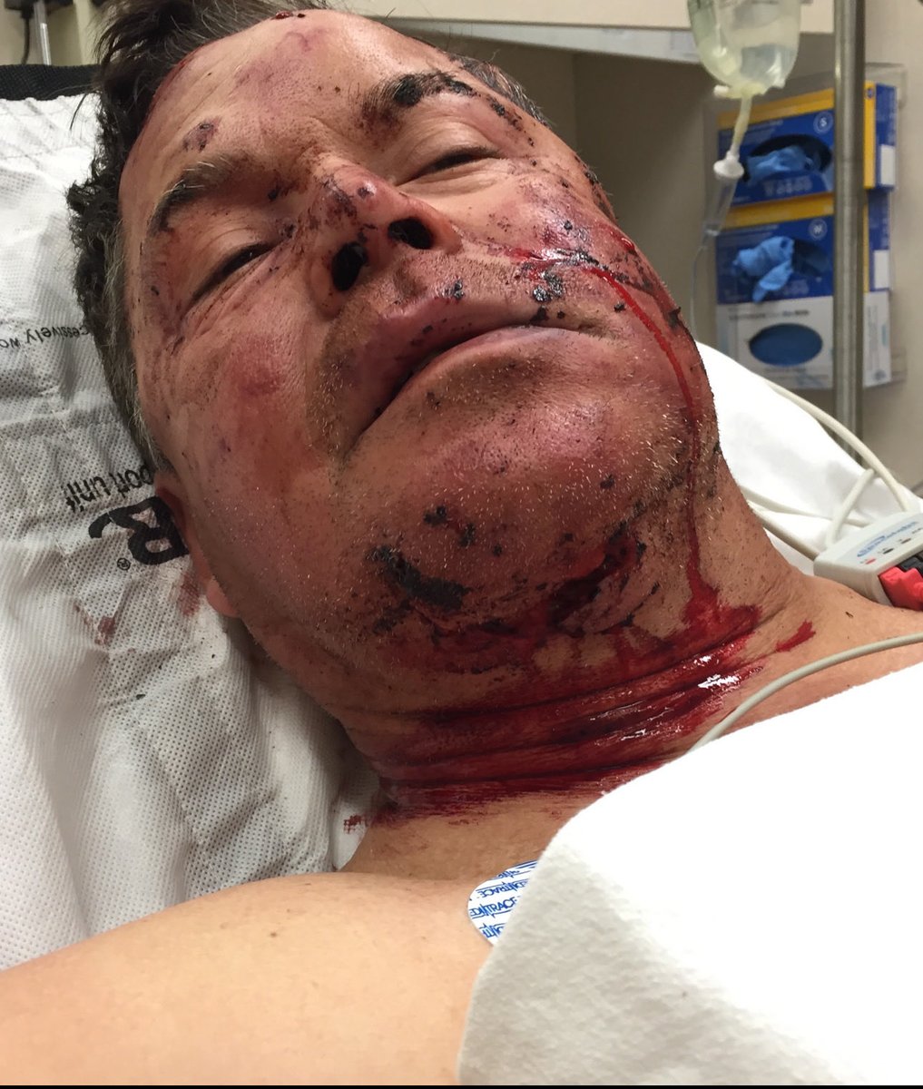 cwmatters2day's tweet photo. From the publishing of my book Wild Awakening, so many have asked to see images of my injuries. The grizzly attack was both devastating and life changing in an amazing way. https://t.co/nb4IUKVXQE