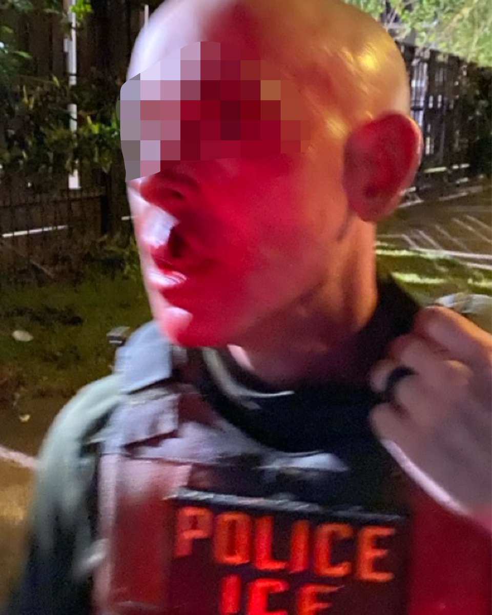 ICE officer BRUTALLY ASSAULTED during arrest of pedophile Salvadoran criminal illegal alien.

On Monday November 3, ICE Houston conducted an enforcement operation to apprehend Walter Leonel Perez Rodriguez, a criminal illegal alien from El Salvador. His criminal history includes