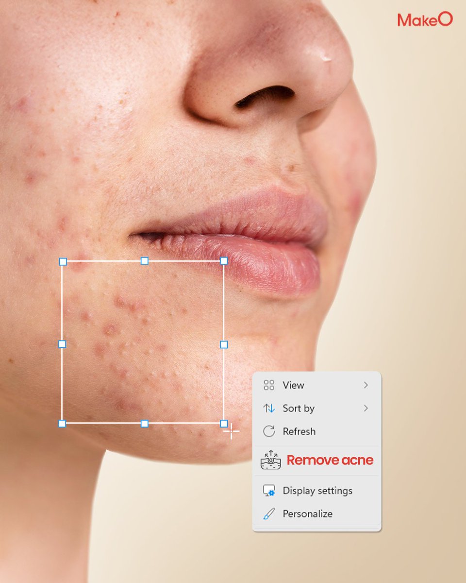 makeO_skin's tweet image. Ready to get rid of acne and blemishes for good? 🤫

Tap the link in bio to book your treatment and hit ‘remove’! ✨

#MakeO #MakeOskin #dullskin #facial #skincare #skintreatment #oilyskin #freshskin #hydratingskincare #glowingskin #glow #youngskinforever #makeOver