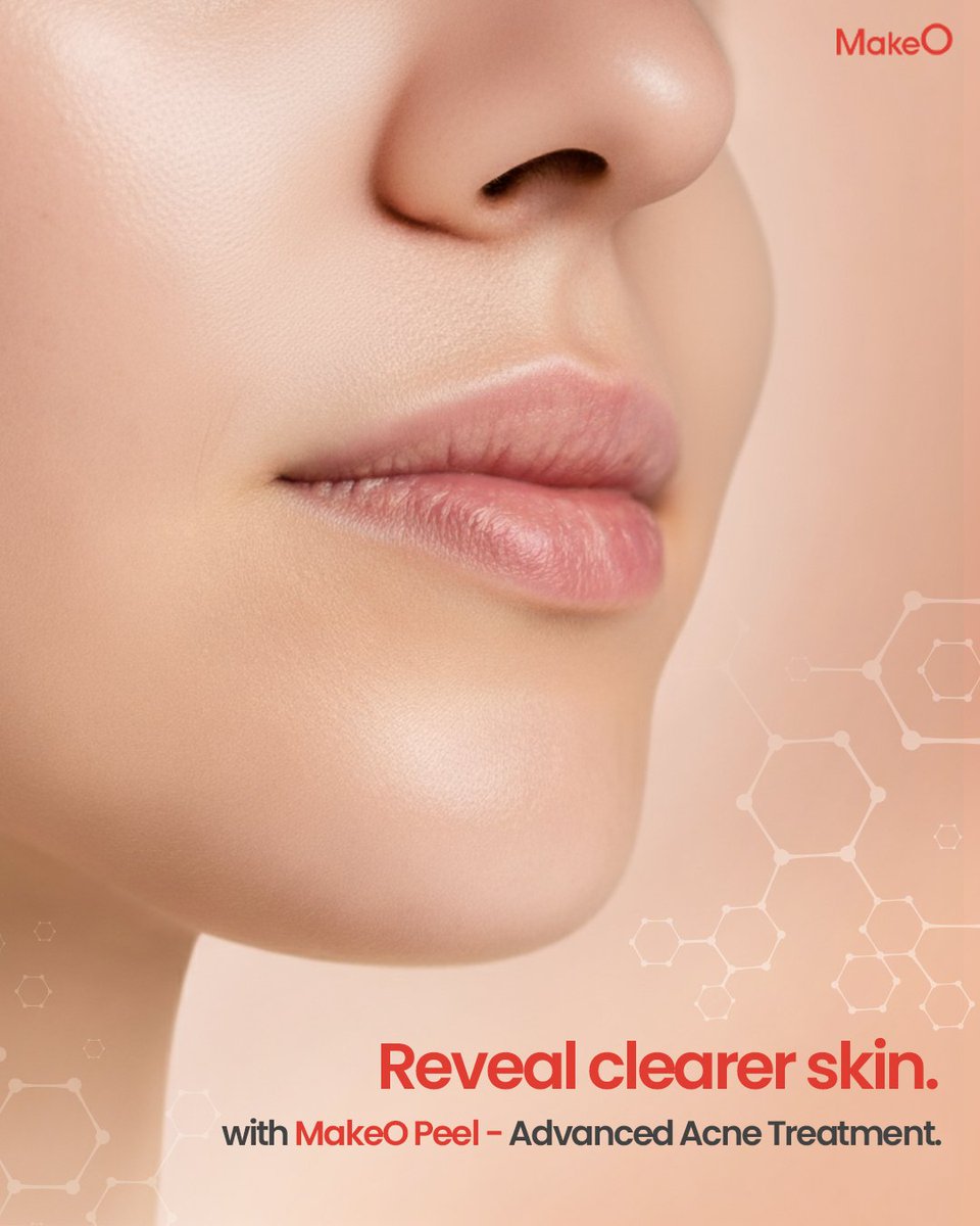 makeO_skin's tweet image. Ready to get rid of acne and blemishes for good? 🤫

Tap the link in bio to book your treatment and hit ‘remove’! ✨

#MakeO #MakeOskin #dullskin #facial #skincare #skintreatment #oilyskin #freshskin #hydratingskincare #glowingskin #glow #youngskinforever #makeOver