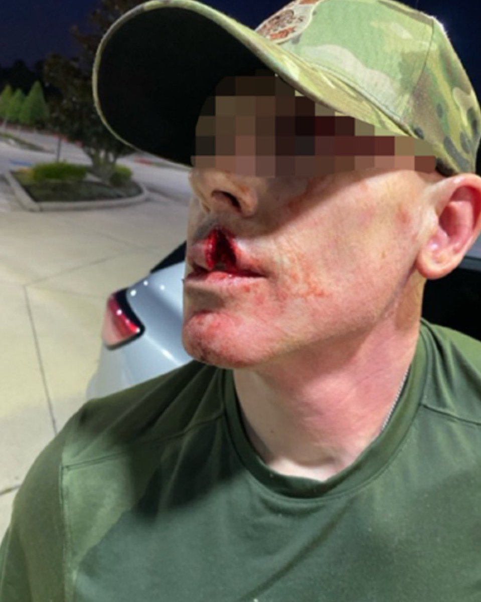 NEW: DHS says an ICE officer in Houston needed 13 stitches after a Salvadoran illegal alien convicted pedophile assaulted him with a metal coffee mug during arrest on Monday, splitting his lip open. Walter Leonel Perez Rodriguez has prior convictions for sexual assault of a