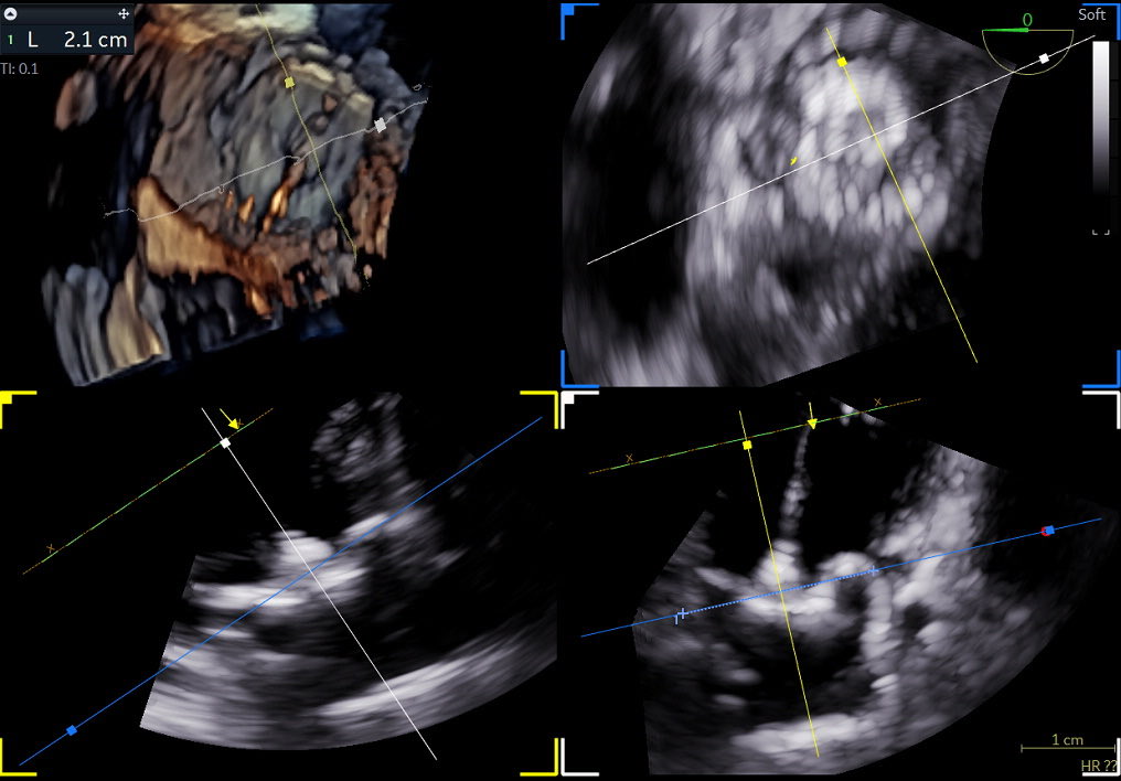 Emad Aziz tweet media