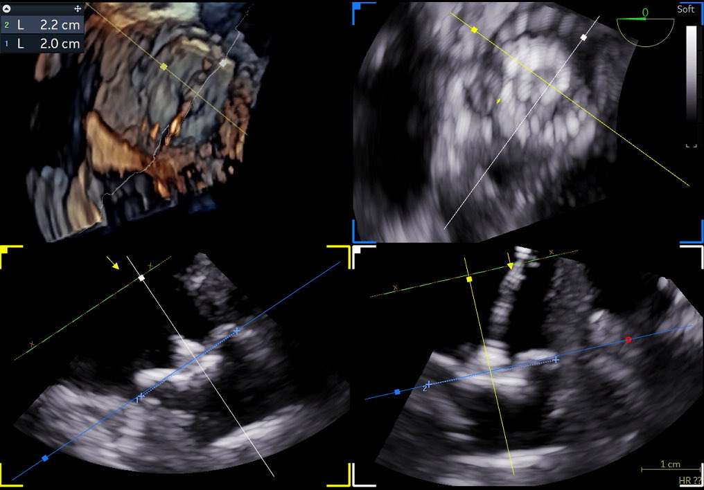 Emad Aziz tweet media