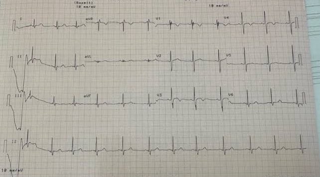 Oktay Gülcü ,MD tweet media