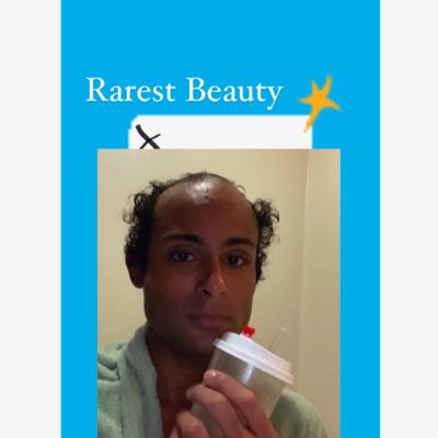 AnthonyDiare's tweet image. #NewProfilePic Keep it 🅿️ #Rare #Rarest