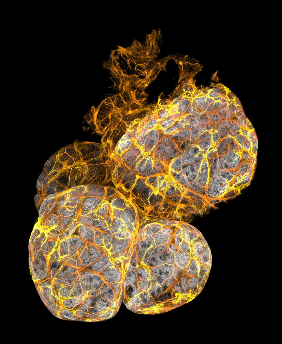 🚨Inmunoterapia desde dentro del propio tumor. Científicos del MIT logran que las células cancerosas produzcan las señales que activan su destrucción, se delatan y el sistema inmune ataca. Un uso del ARN mensajero con muchísimo potencial. bit.ly/47IRrld <a href="/Beaglestana/">Beaglestana</a>