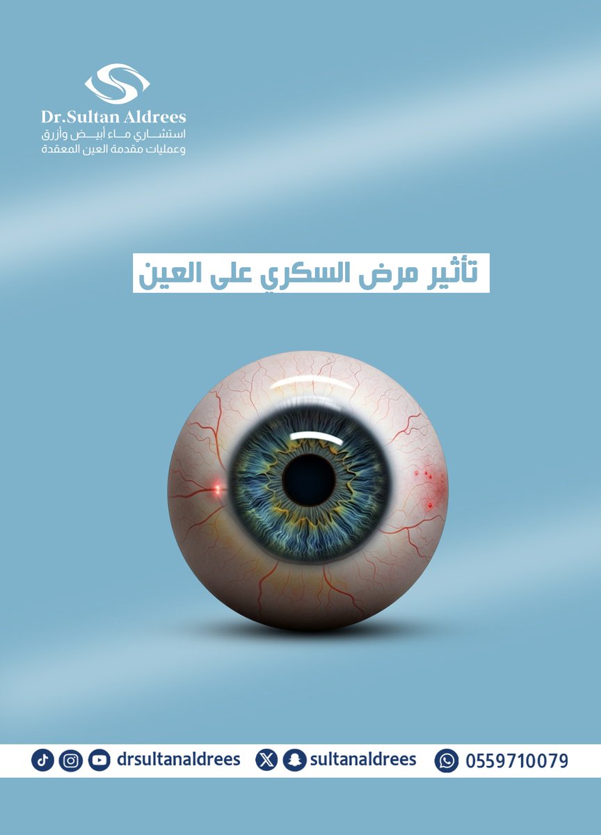 د. سلطان الدريس MD MSc FRCSC tweet media