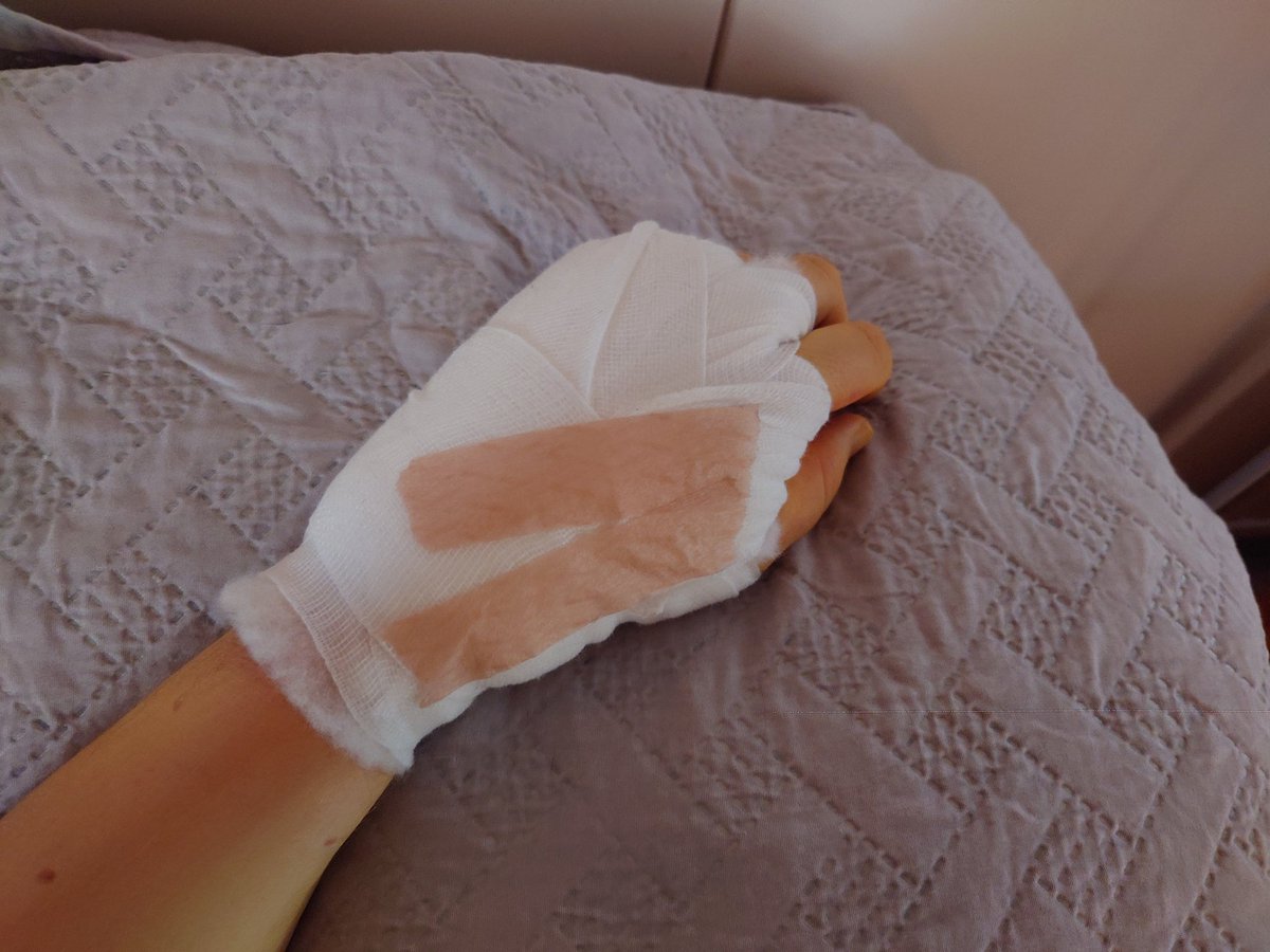 _3hat's tweet image. Kymmeneltä tänään sairaalaan, tunnin päästä pois. Nyt on sitten vasemmankin käden rannekanava leikattu.