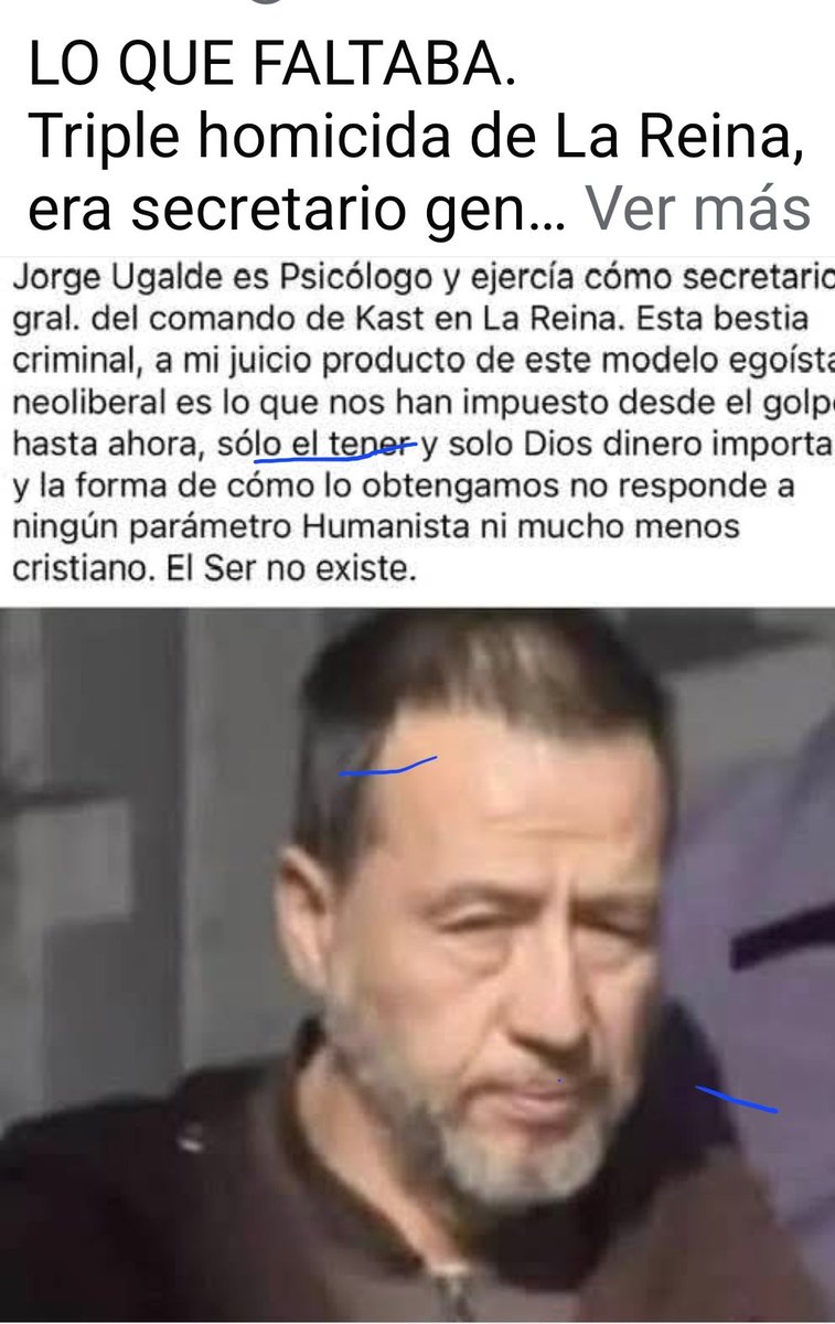 "PARA MUESTRA UN BOTÓN"
Lo que nos espera si gana el kast.