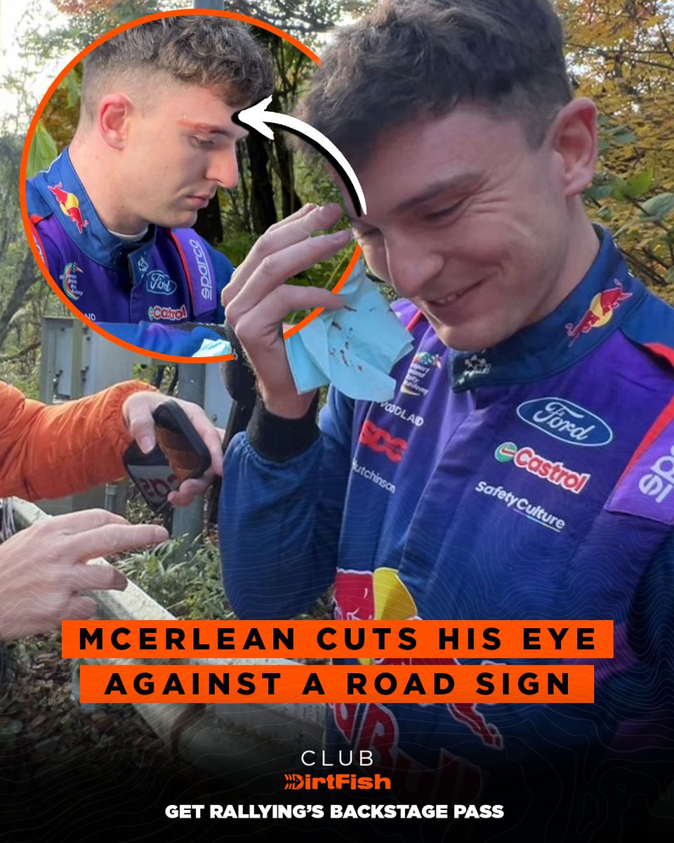⚠️ Accidents happen off the stages too

Josh McErlean cut his eye this morning, ducking his head and hitting a road sign