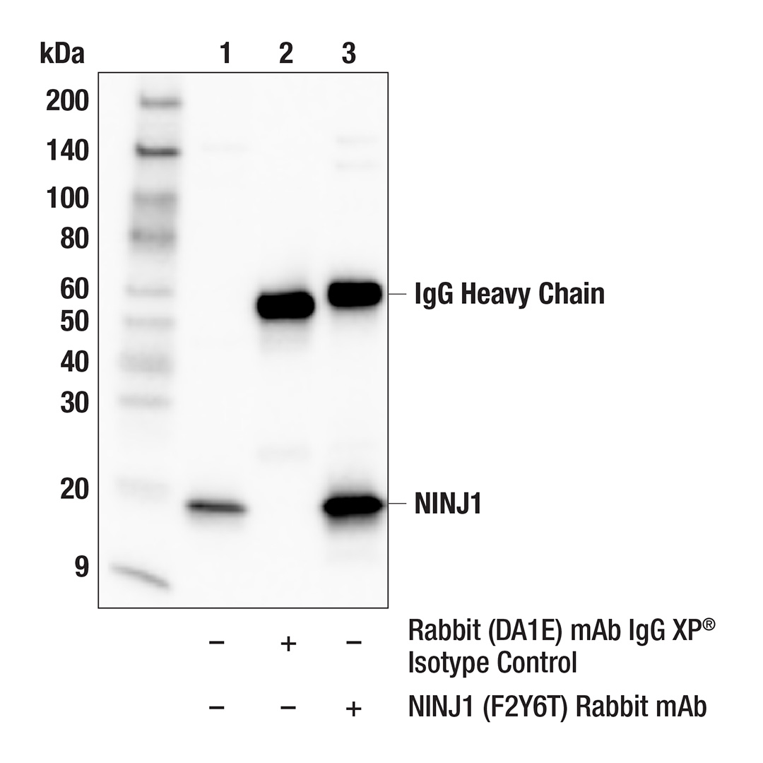 CellSignaling's tweet image. 膜貫通タンパク質NINJ1は、アポトーシスやネクロプトーシス、パイロトーシス、フェロトーシスなど様々なプログラム細胞死経路や、免疫細胞と内皮細胞の細胞間相互作用の促進、炎症細胞の血液脳関門通過などにも関連しています。#49761 はヒトサンプルのWBとIPに適しています。hubs.ly/Q03Q8PNW0