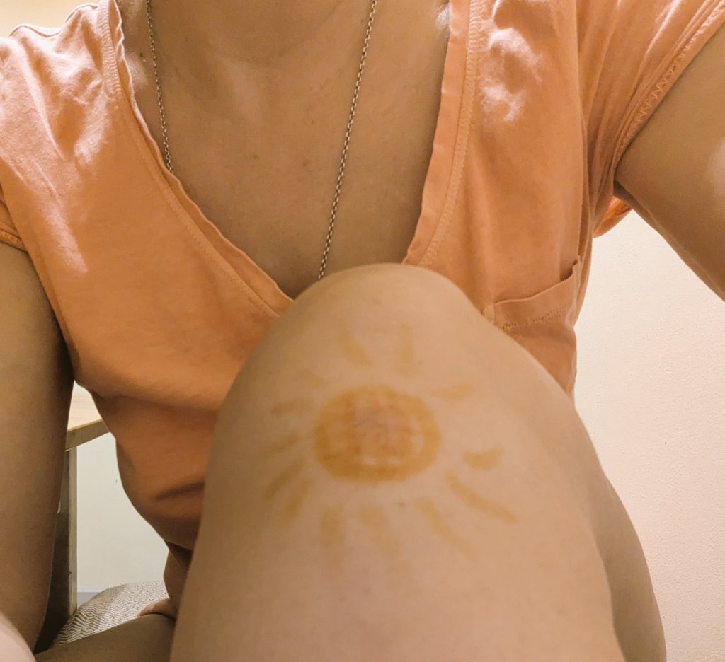 По совету неравнодушных место падения было художественно обработано дезинфицирующими  средствами 🥰