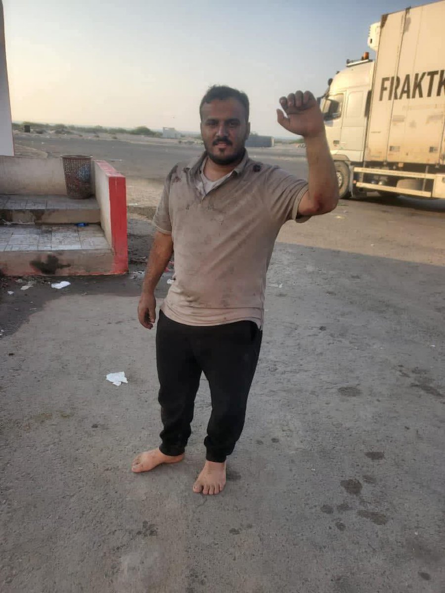 هذا الشخص أسمه/ عبدالله أنيس السعيدي.  
أحد الناجين من حادث باص النقل الجماعي 
الذي انقلب وحرق أسفل نقيل العرقوب 
راح ضحية الحادث العشرات. 

رحمهم الله بينهم ثلاثة أصدقاء 
أحدهم كان موعد زفافه بعد عشرة أيام فقط. 

مقيت خليل النجار

#اليمن