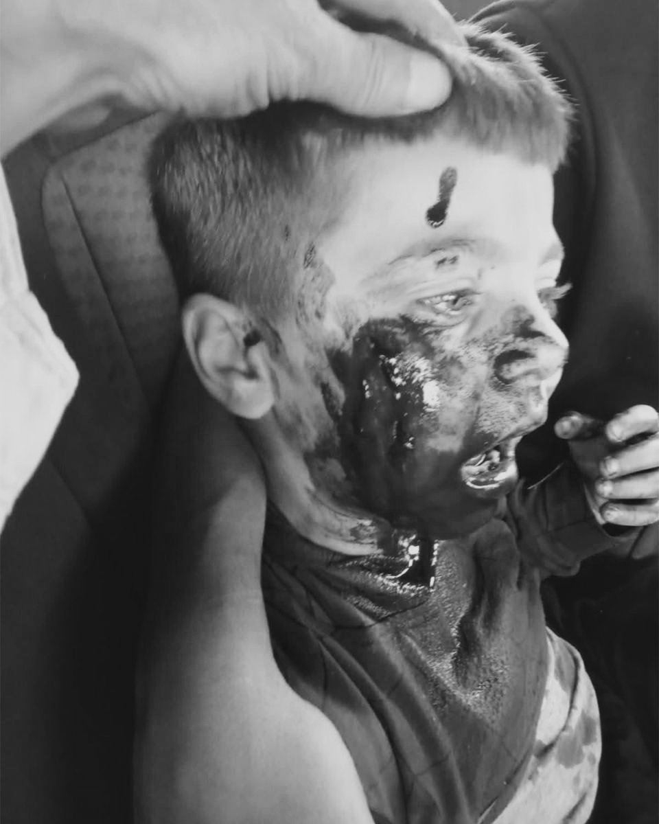 Yahudi işgalciler, Batı Şeria'da saldırdıkları Filistinli çocuğu yaraladı.